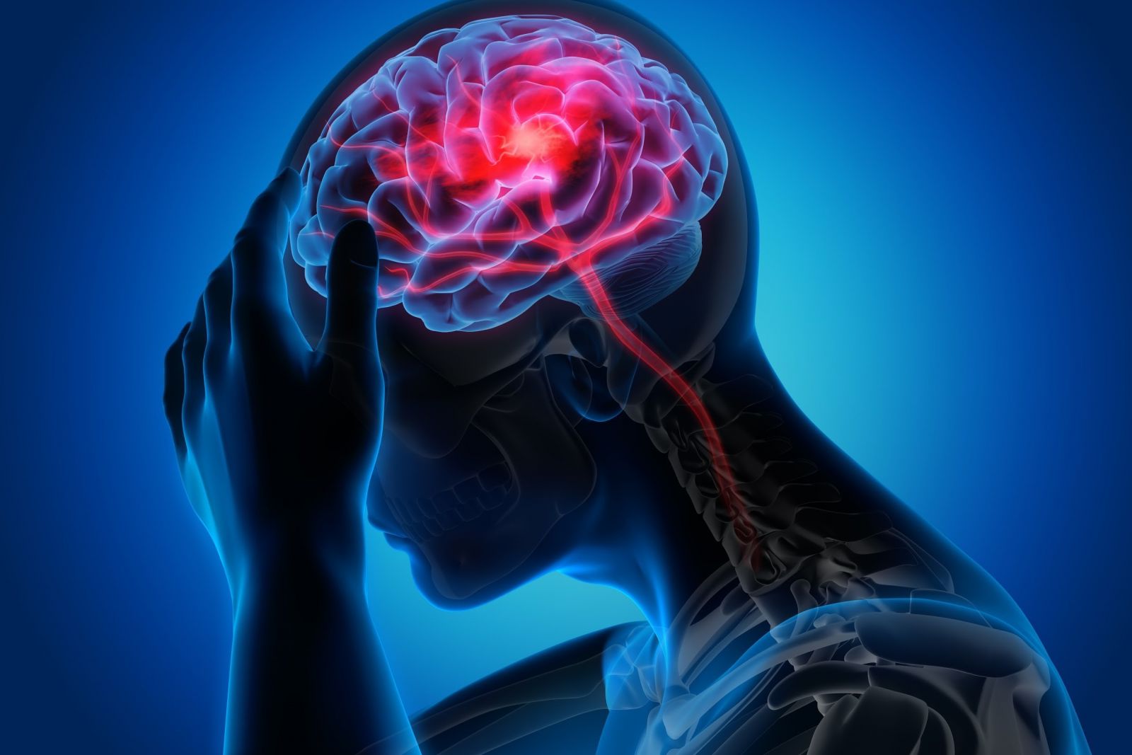 thiếu máu não cũng là một phân nguyên nhân 